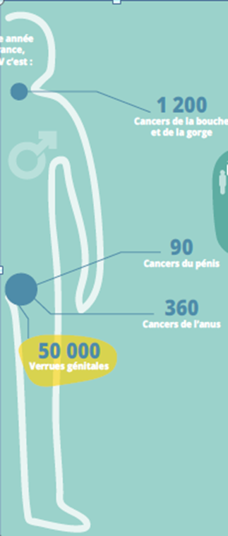 Infographie - nombre de cancers