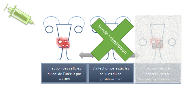 papillomavirus et douleur articulaire